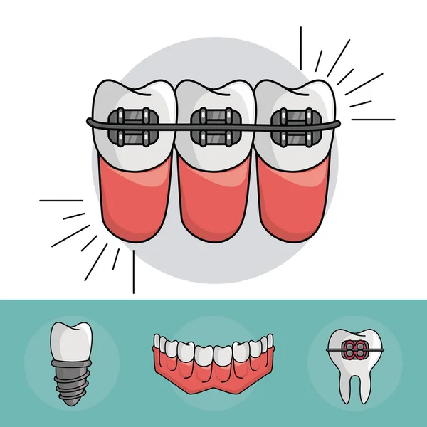 Dental braces elements — Stock Vector