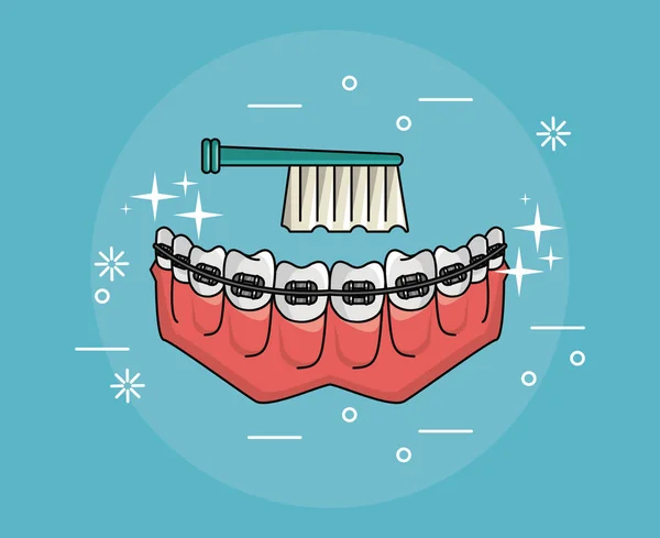 Dientes con frenos higiene dental — Vector de stock