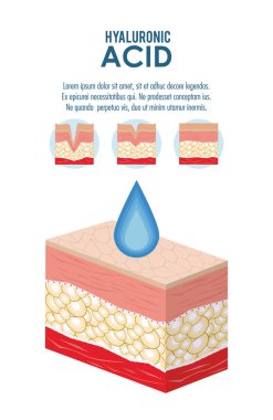 Hyaluronik asit dolgu enjeksiyonu Infographic