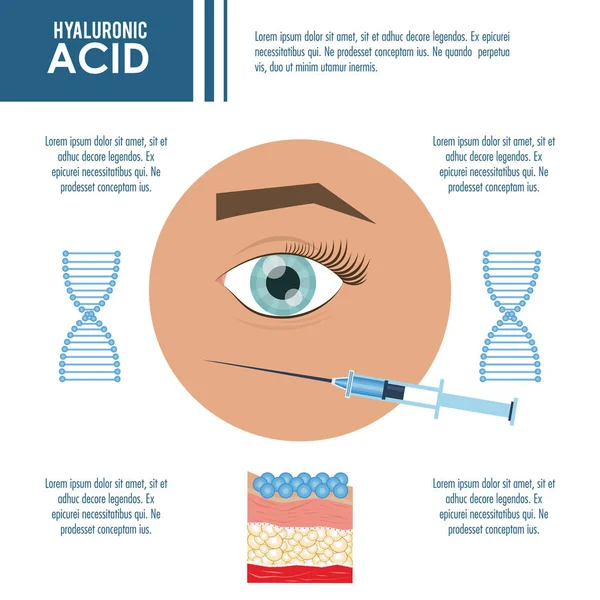 Hyaluronzuur filler injectie infographic — Stockvector