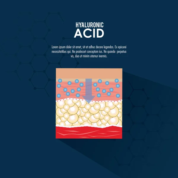 Infografica iniezione filler acido ialuronico — Vettoriale Stock