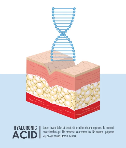 Infográfico de injeção de enchimento de ácido hialurônico — Vetor de Stock