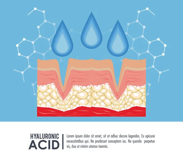 Infografica iniezione filler acido ialuronico — Vettoriale Stock