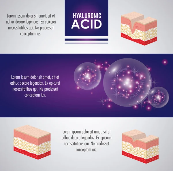 Infográfico de injeção de enchimento de ácido hialurônico — Vetor de Stock