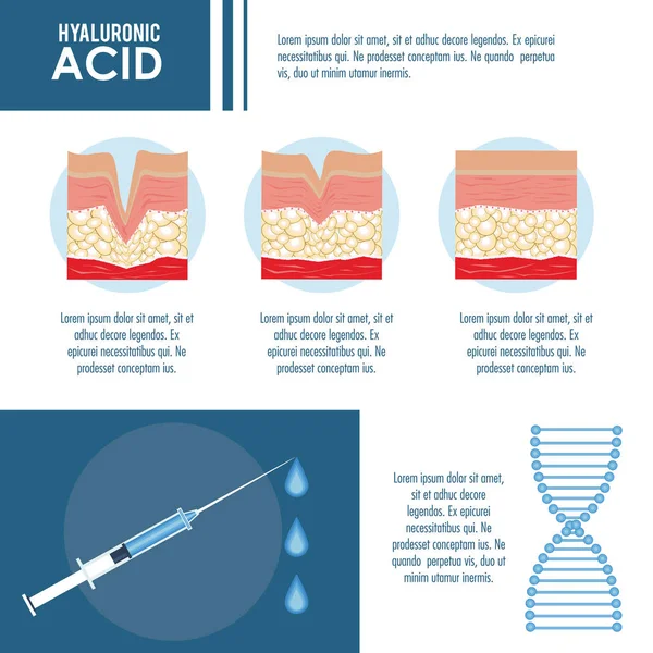 Hyaluronzuur filler injectie infographic — Stockvector