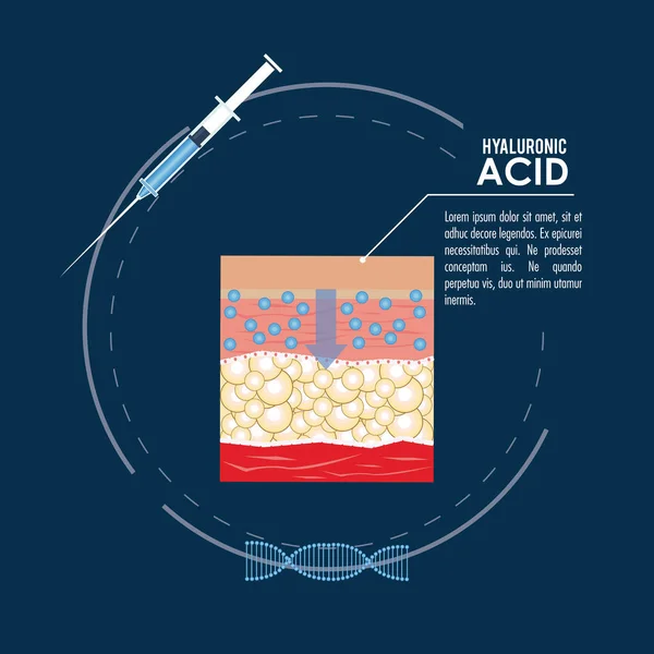 Hyaluronsyra filler injektion infographic — Stock vektor