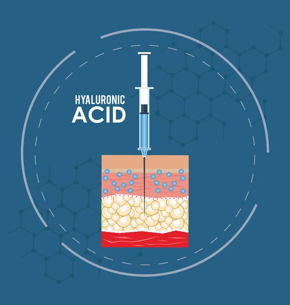 Гіалуронова Кислота Наповнювач Інфографічний Флаєр Векторні Ілюстрації Графічний Дизайн — стоковий вектор