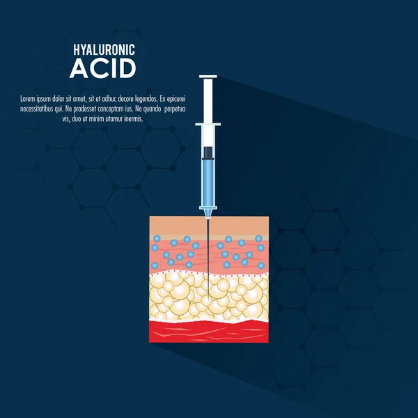 透明质酸填料注入信息图 — 图库矢量图片