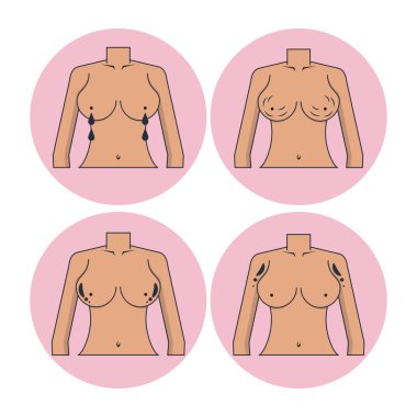 Meme kanseri simgeler kümesi