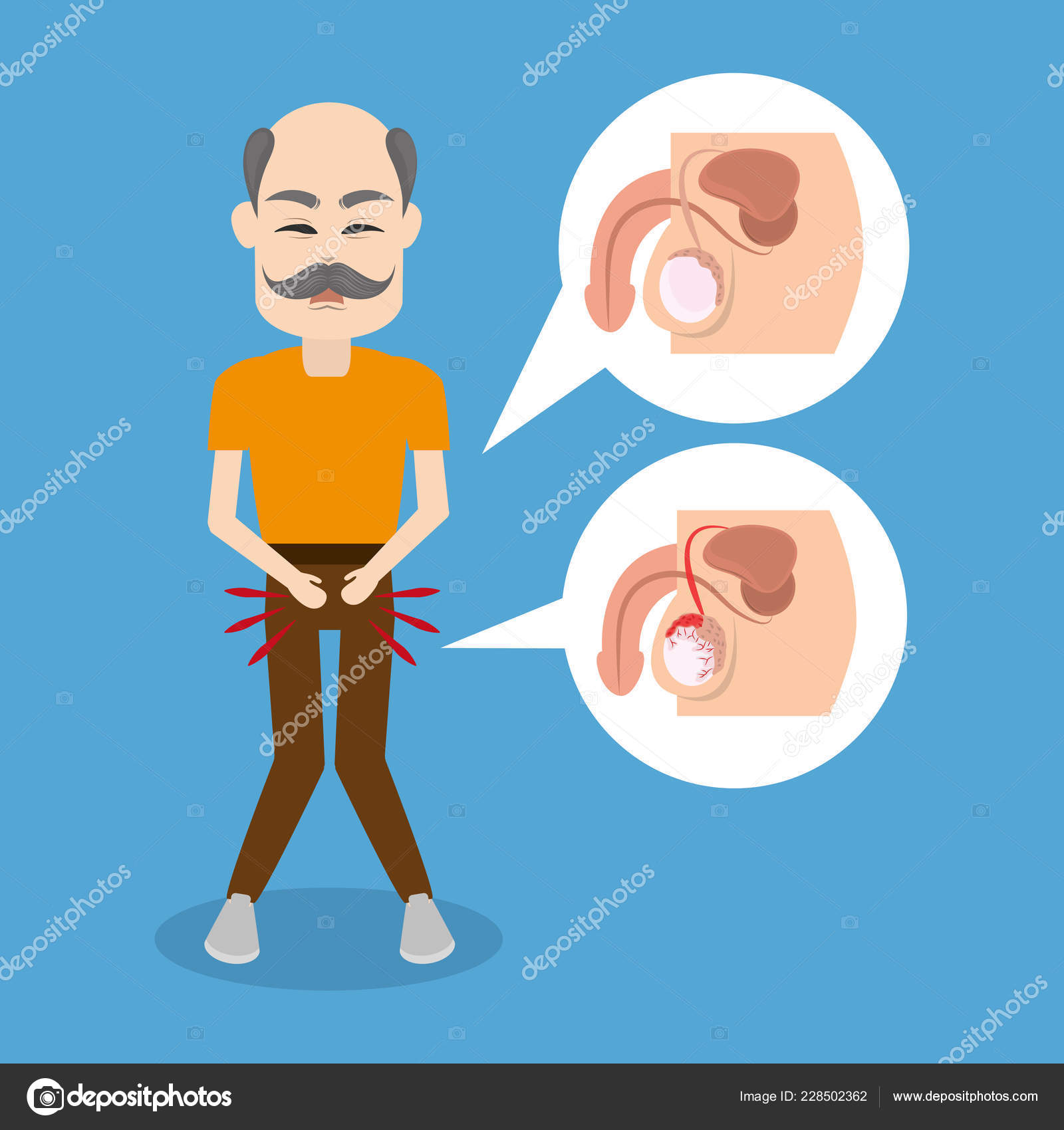 Prostate cancer campaign Stock Vector Image by ©jemastock #228502362