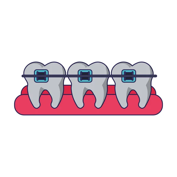Diş diş teli ile — Stok Vektör