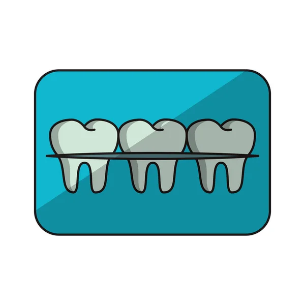 Zähne mit Zahnspange Banner Karikatur isoliert — Stockvektor