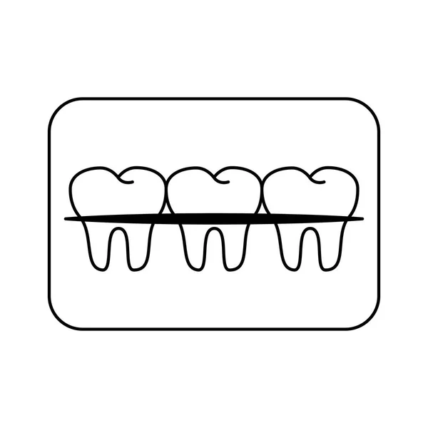 Teeth with braces banner cartoon isolated black and white — Stock Vector