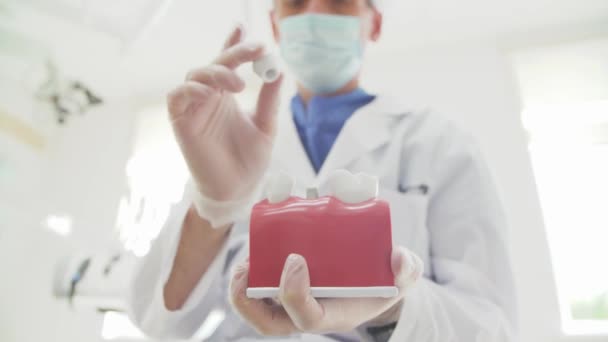 Médico Dentista Segura Sua Mão Layout Dos Dentes — Vídeo de Stock