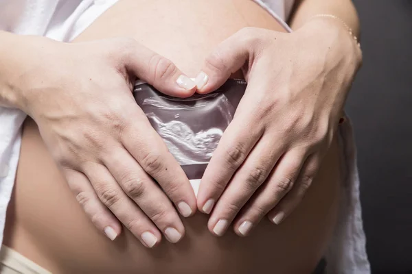 Mulher Grávida Segurando Foto Exame Ultra Som Seu Estômago — Fotografia de Stock