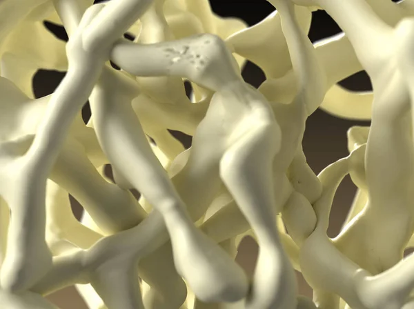 Osteoporoza Spojrzeć Kości Renderowania — Zdjęcie stockowe
