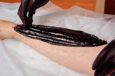 Epilasyon için siyah Yapıştır sugaring saçlı bir bacak tarafından uygulama siyah eldiven El. 