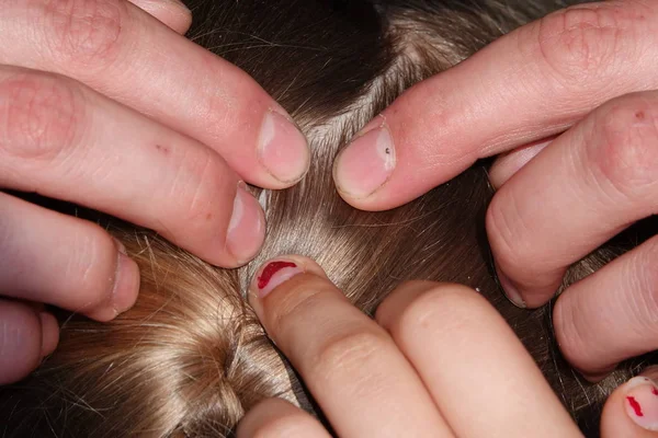 Comprobación de un pelo de chicas jóvenes para piojos de la cabeza — Foto de Stock