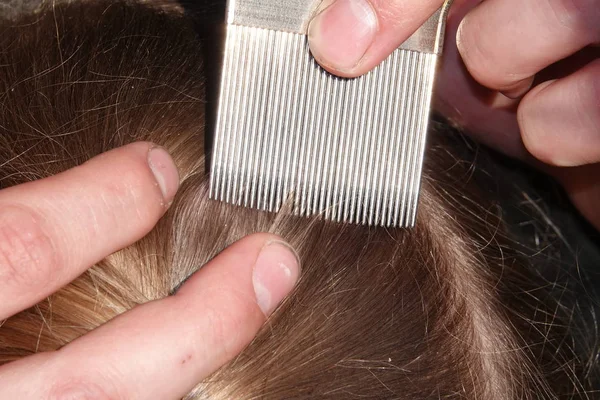 Kontrollera en unga flickor hår för huvudlöss — Stockfoto