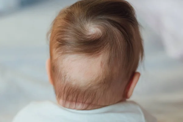 Tache Chauve Arrière Tête Bébé — Photo