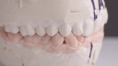 balmumu Silindirler çene kapatma belirlemek için diş modeli
