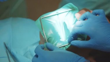 Dişçi hastalar ağız içine bir Cofferdam koyar. 4k