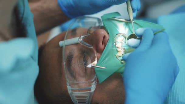 Dentista que trata um paciente usando cofferdam. 4K — Vídeo de Stock