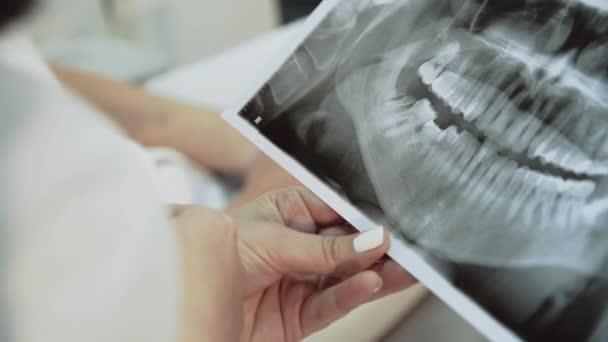 Vrouwelijke handen houdt tandheelkundige x-ray beeld voor het analyseren. 4k — Stockvideo