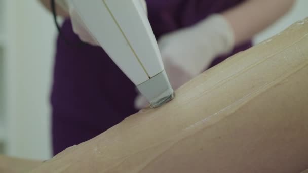 Het concept van ontharing laser wordt gebruikt op vrouwelijke benen in schoonheidskliniek — Stockvideo
