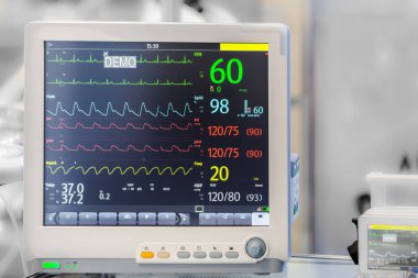 kardiyogram üstünde belgili tanımlık perde, arka plan görüntüsü ile metin için yer ile Diagnostik tıbbi donatımı