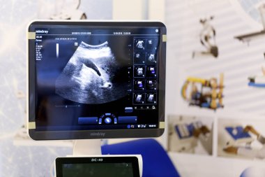13 Eylül 2018 ultrason makinesi bir sergi Moldexpo, Kişinev, Moldova