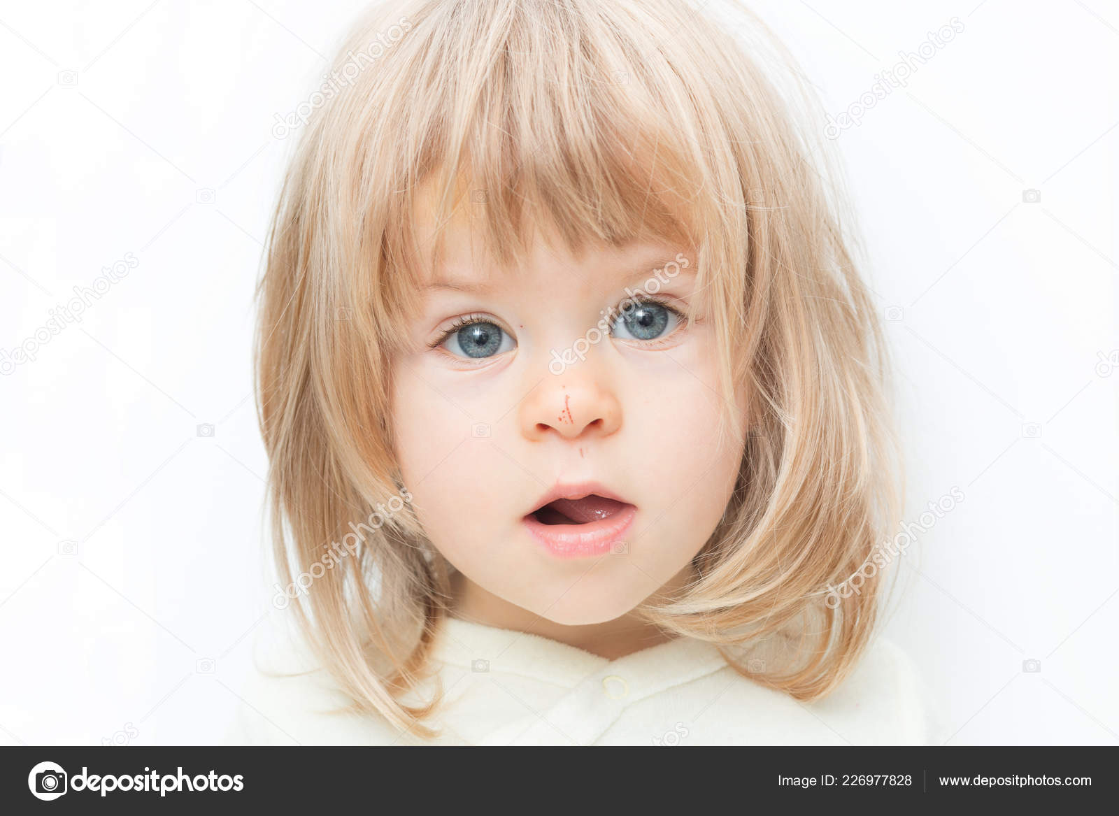Close Up Portrait Blond Hair Baby Girl With A Scratch On Her Nose