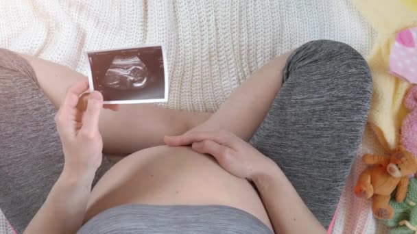 Pregnant woman holding ultrasound image. Concept of pregnancy. Top view — Stock Video