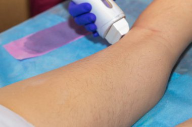 Kadın saç çıkarma yordamı ile balmumu depilatory salonda bacak üzerinde sahip. Depilasyon kavramı.