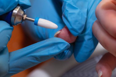 Manikür süreci yakın çekim. Eski dekoratif Freze Makinası ile oje kaldırma