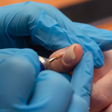 Manikür süreci yakın çekim. Eski dekoratif Freze Makinası ile oje kaldırma