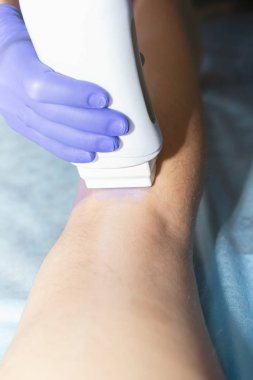 Kadın saç çıkarma yordamı ile balmumu depilatory salonda bacak üzerinde sahip. Depilasyon kavramı
