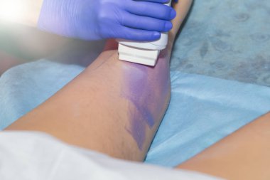 Kadın saç çıkarma yordamı ile balmumu depilatory salonda bacak üzerinde sahip. Depilasyon kavramı