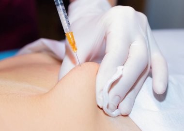 Güzellik hasta Anti-Selülit enjeksiyon yapar. Close. Vücut Bakımı konsepti