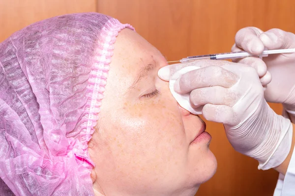 Inyección de ácido hialurónico para rejuvenecimiento facial. Primer plano — Foto de Stock