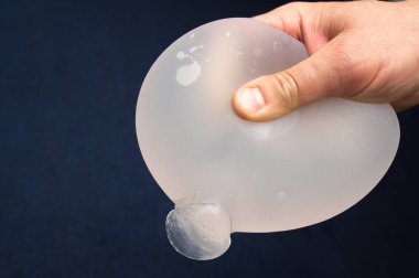 Meme implantı güvenilirliğini gösteri. Zaman ürünün mekanik zarar jel dökülen yerine implant içinde kalır.