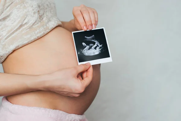 腹の背景に妊娠中の女の子の手の中の超音波を写真します。 — ストック写真