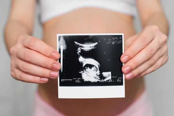 Foto-Ultraschall in den Händen eines schwangeren Mädchens auf einem Bauch Hintergrund — Stockfoto