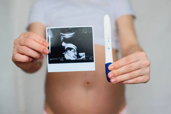 Ultraschallbild und positiver Schwangerschaftstest in den Händen einer Schwangeren — Stockfoto