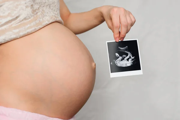Foto eines schwangeren Ultraschalls in den Händen eines schwangeren Mädchens — Stockfoto