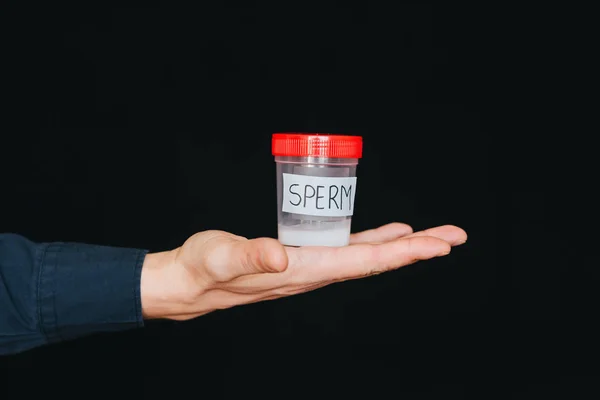 Behälter mit Sperma in der Hand eines männlichen Spenders — Stockfoto