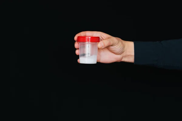 Behälter mit Sperma in der Hand eines männlichen Spenders — Stockfoto