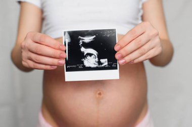 hamile bir ultrason hamile bir kız elinde fotoğrafı