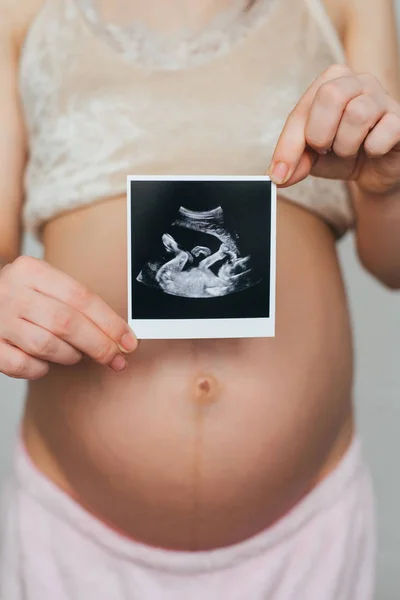 Ecografia foto nelle mani di una ragazza incinta su uno sfondo pancia — Foto Stock