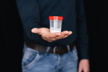 testler ve testler için bir erkeğin elinde sperm Bankası